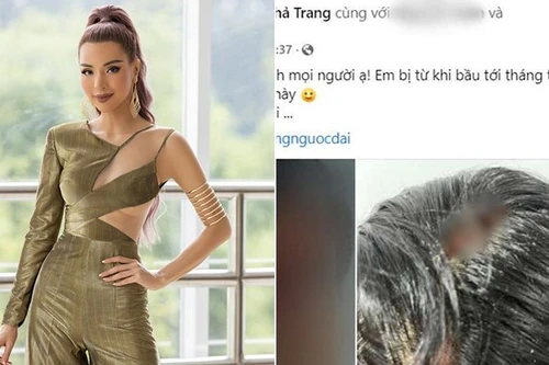 [Tin nhanh tối 03-12-2021] Công an vào cuộc vụ siêu mẫu Khả Trang tố bị bạn trai bạo hành