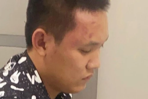 [Tin nhanh tối 6-10-2022] Đâm đồng nghiệp tử vong vì mâu thuẫn nhắc nhở sử dụng điện thoại