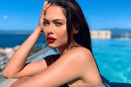 [ẢNH] Cận cảnh nhan sắc thật ngoài đời của Tân Hoa hậu Hoàn vũ thế giới - Miss Universe 2020