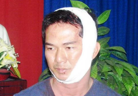 Truy tố kẻ cuồng sát tại cửa hàng thời trang Sóng Nhạc