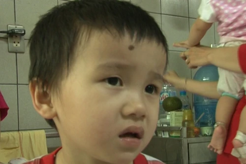 Cấp cứu cho bé trai 4 tuổi ngộ độc do uống thuốc lá cây rừng