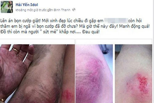 Hàng loạt sao Việt từng trầy da xước mặt vì bị cướp giật ở TP.HCM