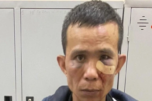 Kẻ có 6 tiền án lại 'ngựa quen đường cũ' đi trộm cắp tài sản