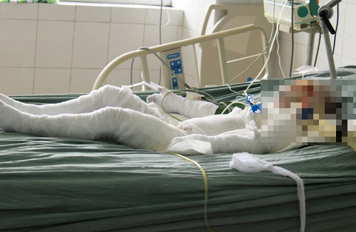 Nạn nhân vụ rưới xăng, đốt cả nhà đã chết