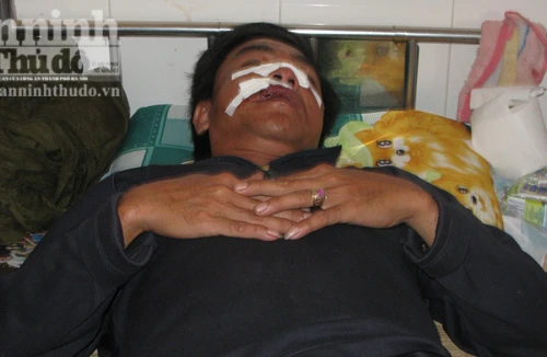 Bị chặn xe, lâm tặc trút gỗ, tấn công kiểm lâm