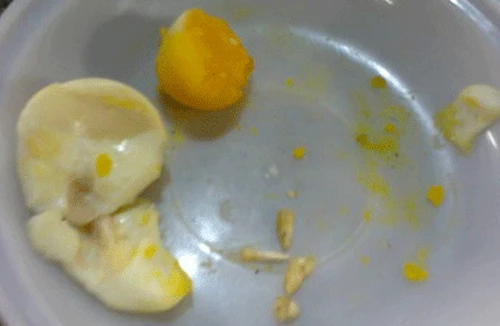 Phát hiện chất lạ trong lòng đỏ trứng gà