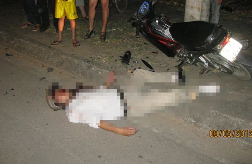 Giáo viên say rượu... tông vào trụ điện chấn thương sọ não