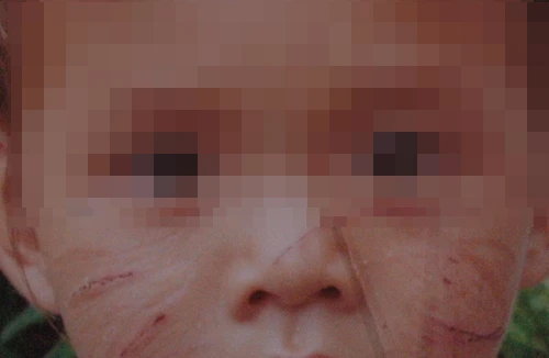 "Ngứa mắt", 4 lần dùng kéo rạch mặt bé trai hàng xóm mới 20 tháng tuổi