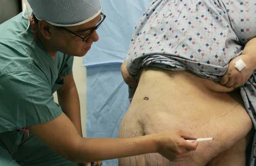 Điều trị bệnh tiểu đường: Tự bỏ đói