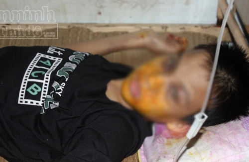 Bắt đối tượng hành hạ cháu bé bị câm bẩm sinh trong khách sạn