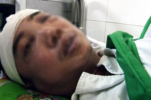 Thuê người đánh dằn mặt đồng nghiệp, 5 đối tượng lãnh án