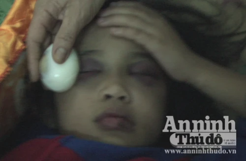 Trước ngày xử vụ cha mẹ nuôi bạo hành cháu Thục Phi