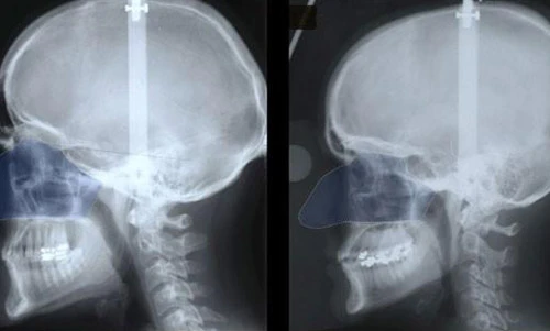 Vì sao mũi đàn ông lớn hơn phụ nữ?