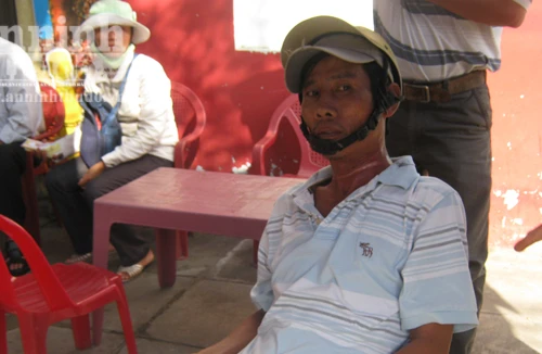 Dây sà xuống đường, cứa cổ người đi đường