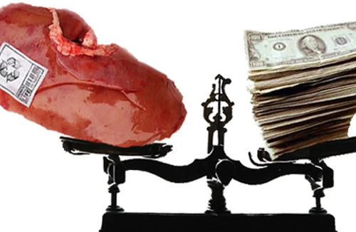 Ukraina: Truy tố kẻ chuyên buôn bán nội tạng người