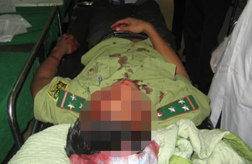 Hàng chục lâm tặc đánh hội đồng 2 kiểm lâm viên