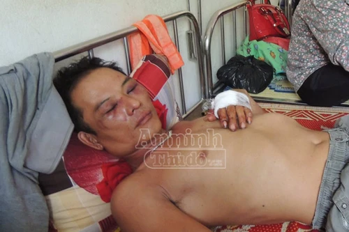 Hà Tĩnh: Côn đồ chặn đường, đánh tài xế xe tải trọng thương