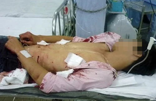 Nhát dao lấy mạng người 