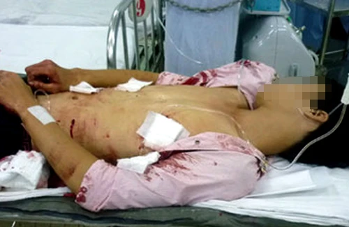 Đối tượng giết người ở ngõ Lò Lợn ra đầu thú