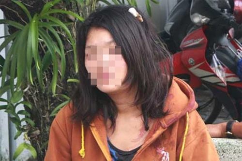 Chủ quán cơm bị gã nhân viên mới đánh đập, đòi tiền