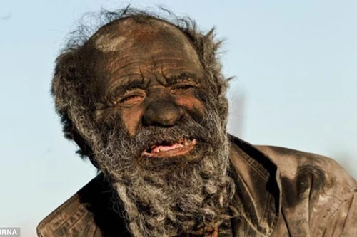 Người đàn ông bẩn nhất thế giới - 60 năm không tắm