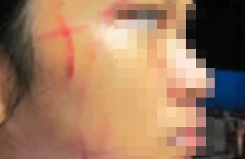 Rạch mặt đối thủ để giành chỗ bán cà phê