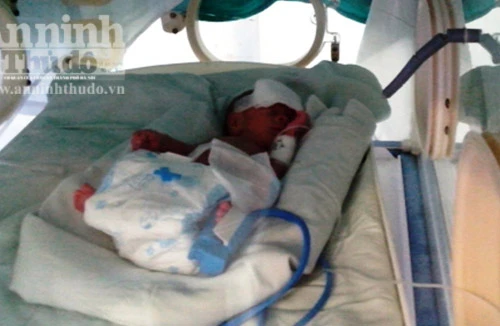 Cứu sống kỳ diệu cháu bé sinh non nặng chỉ nặng 500 gam 