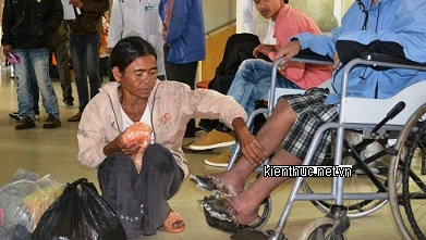 Sợ cưa chân, bệnh nhân “hai chân chết khô”... đòi trốn viện