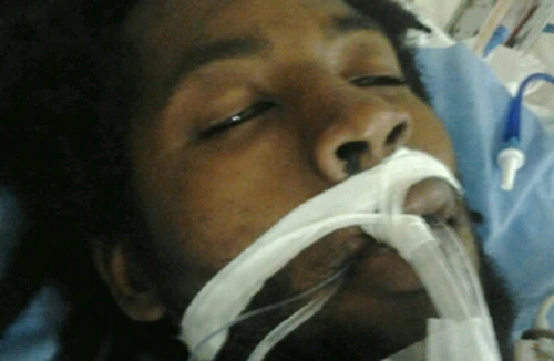 Bị bắn vì trần truồng đột nhập nhà bóp cổ cún cưng