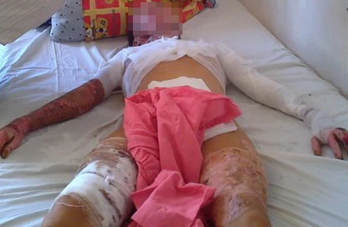 Tưới xăng đốt vợ vì không dậy đi làm đồng