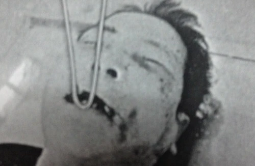 Phát hiện người đàn ông chết bất thường giữa khu trung tâm xã