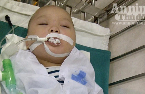 Phẫu thuật thành công cho bé 9 tháng tuổi bị xương đâm thủng ruột