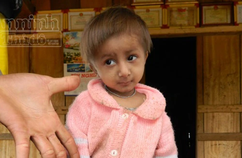 Đưa chú bé “tí hon” điều trị tuyến tỉnh