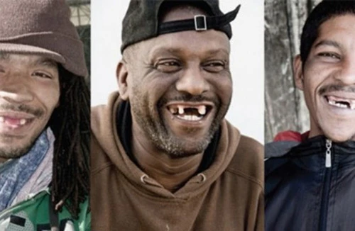 Nơi đàn ông đua nhau… nhổ răng cửa