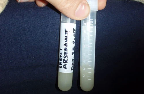 Bị ép phải chu cấp tiền nuôi con sau khi hiến tinh trùng