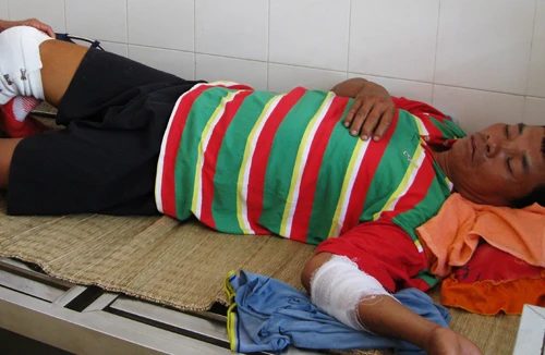 Suýt mất mạng vì bị cá mập tấn công