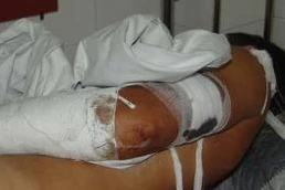 Đâm ô tô vào người, đổ xăng đốt nhà để đòi nợ