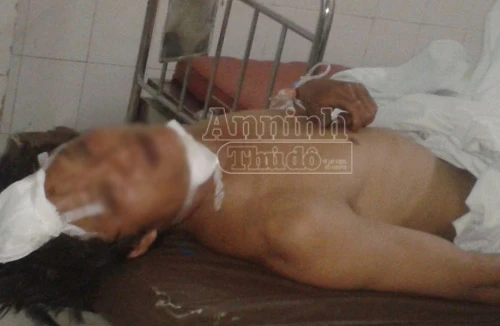 Chồng chém chết vợ rồi tự cứa cổ, uống thuốc độc tự tử