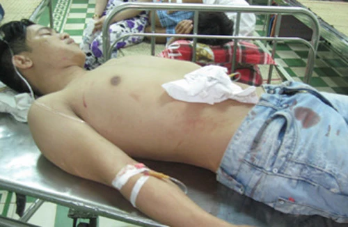 Một thanh niên bị đâm trọng thương đúng mùng 1 Tết