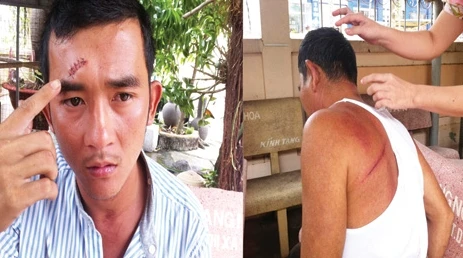 Cả gia đình bị côn đồ truy sát