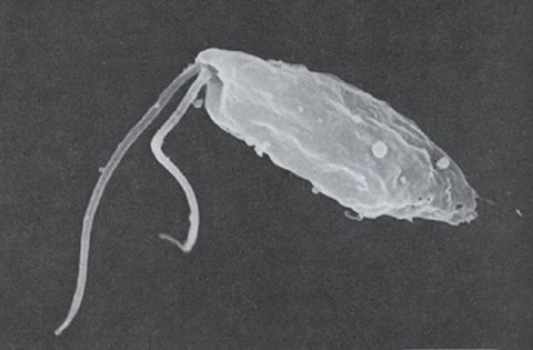 Một cháu bé tử vong, nghi do amip ăn não người