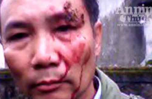 Vừa đến cổng nhà cô dâu thì bị đánh tơi bời