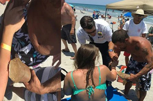 Nhập viện với cá mập dính trên tay