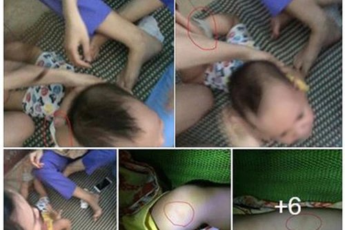 Audio 6-10-2015: Về vụ trẻ bị bạo hành và ô tô chở người Việt gặp nạn tại Lào