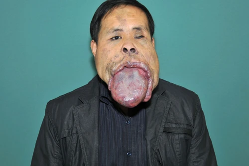 Kinh hoàng với người đàn ông có lưỡi khổng lồ