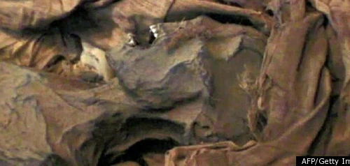 Phát hiện xác ướp cổ bị ung thư tiền liệt tuyến