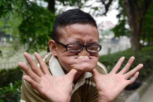 Sốc với người đàn ông tự biến dạng như "mặt quỷ"