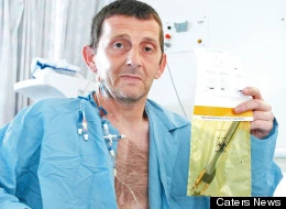 10 năm sống với dĩa nhựa trong bụng