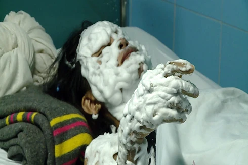 Nổ bóng bay trong đêm Trung thu, 9 người bị thương nặng