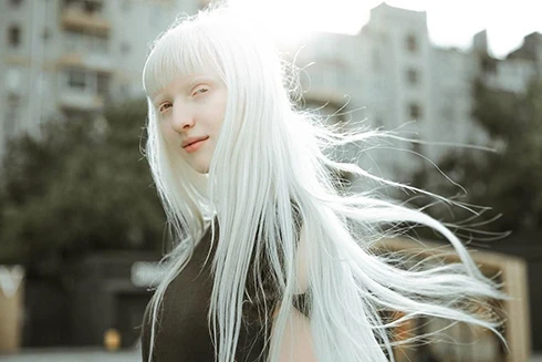 [ẢNH] Ngỡ ngàng trước vẻ đẹp khác biệt của những người mẫu bạch tạng nổi tiếng thế giới